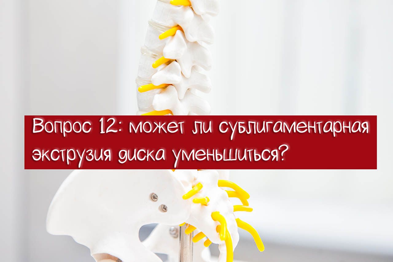 Может ли сублигаментарная экструзия диска уменьшиться?
