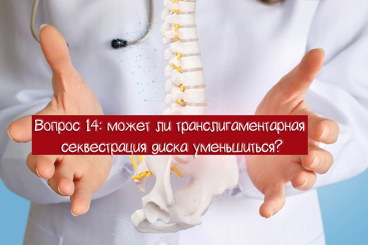 Вопрос 14: может ли транслигаментарная секвестрация диска уменьшиться?